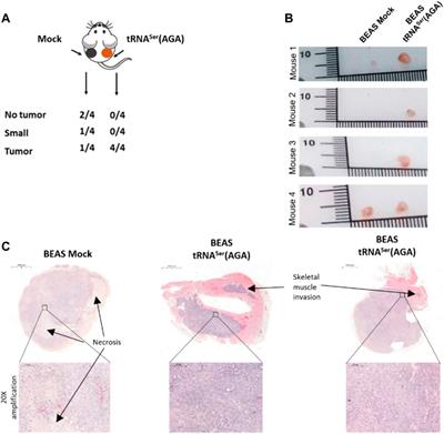 Upregulation of tRNA-Ser-AGA-2-1 Promotes Malignant Behavior in Normal Bronchial Cells